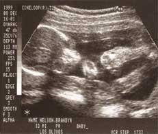 Front of baby