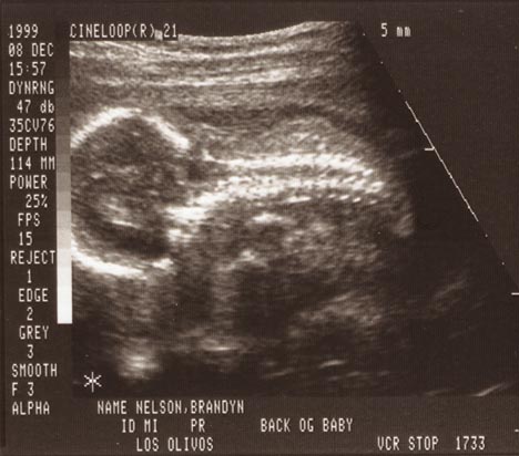Front of baby