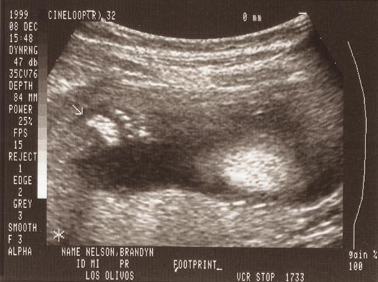 Front of baby