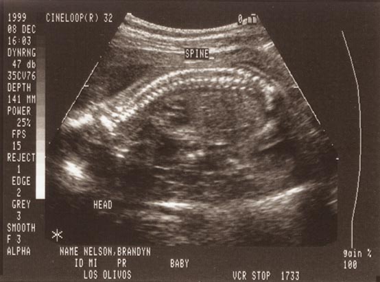 Front of baby